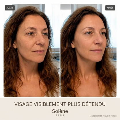 SilkLift® – Sérum Raffermissant aux Peptides de Soie