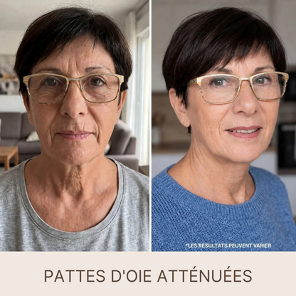 SilkLift® – Sérum Raffermissant aux Peptides de Soie