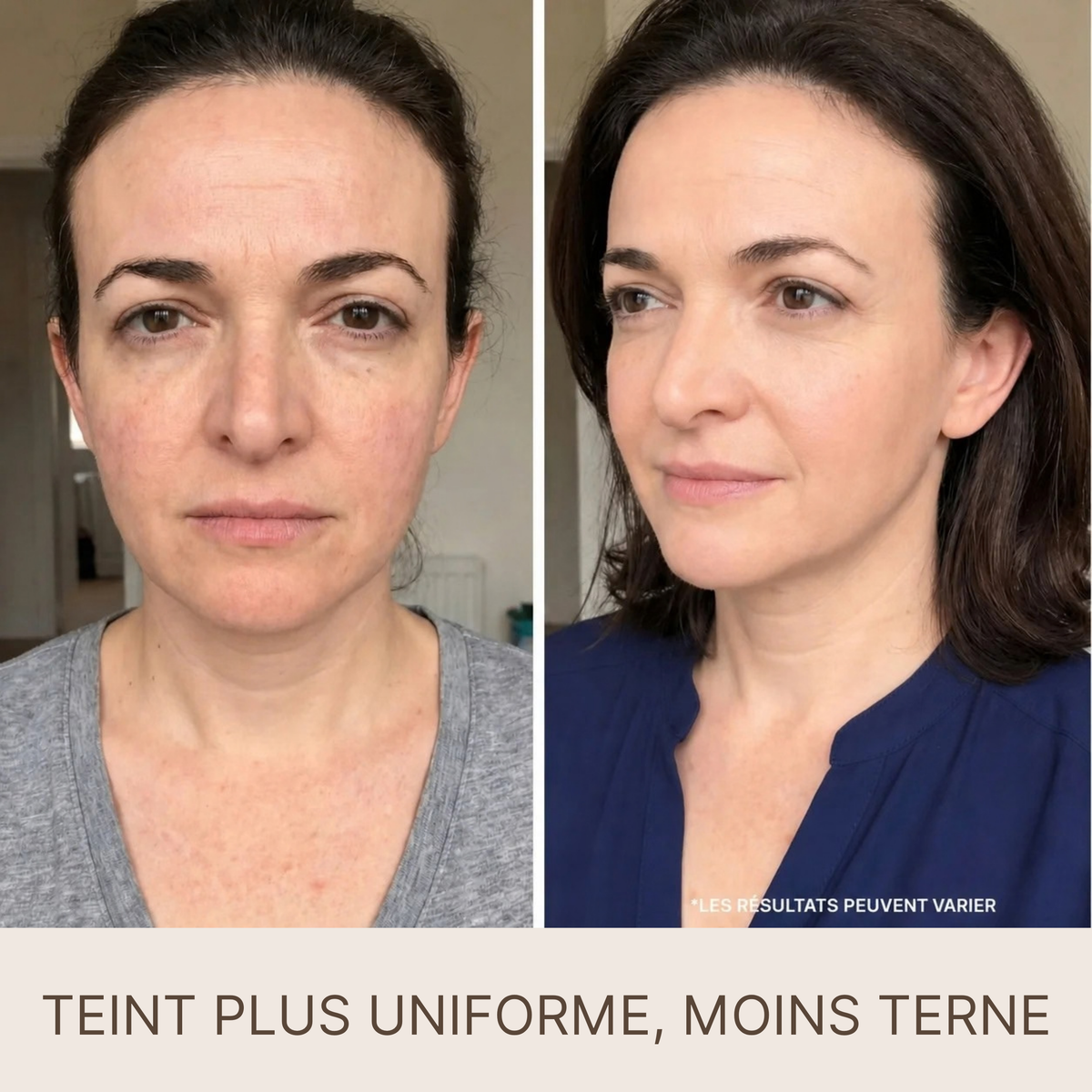 SilkLift® – Sérum Raffermissant aux Peptides de Soie