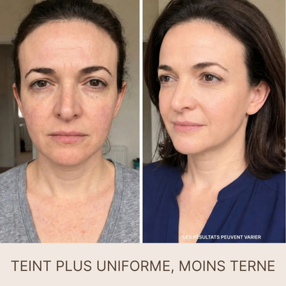 SilkLift® – Sérum Raffermissant aux Peptides de Soie